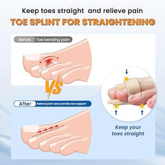 Hyggear™ Hammer Toe Straightener - 1198462745673