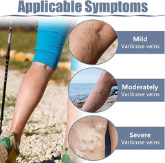 Hyggear Varicose Veins Patch - Natural Relief Treatment for Legs, Spider Varicose Vein and Strengthen Capillary Health