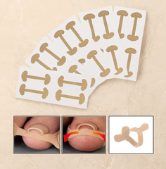 Hyggear Ingrown Toenail Set with Breathable Ingrown Toenail Strips