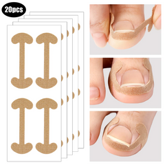 Hyggear Ingrown Toenail Set with Breathable Ingrown Toenail Strips