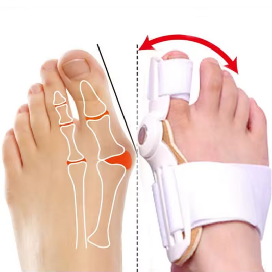 Hyggear Hallux Valgus (Bunion)-Korrektor
