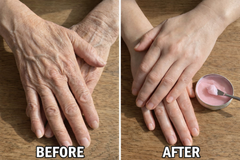 Hyggear™ DermaRestore for Crepey Skin - 657382643782286